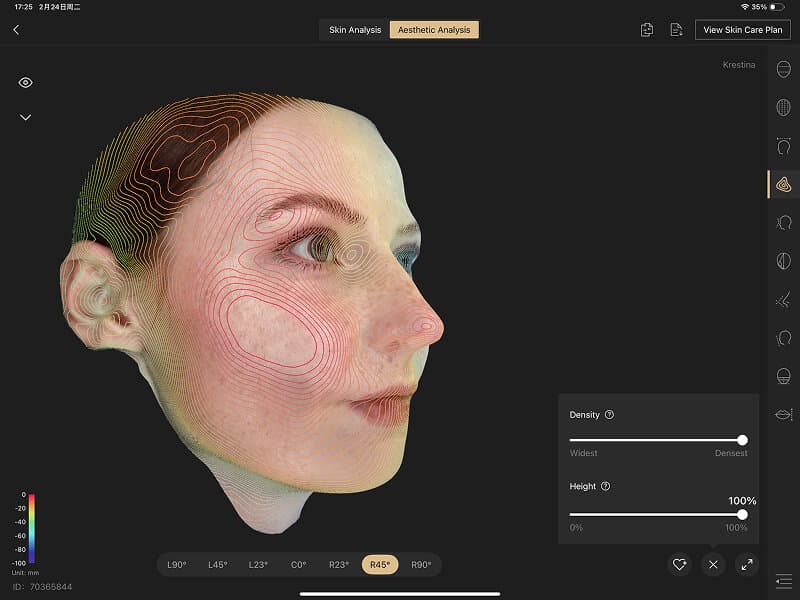 Facial Contour Analysis