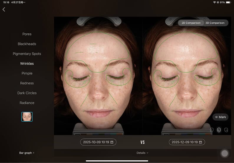 Side-by-Side Progress Verification