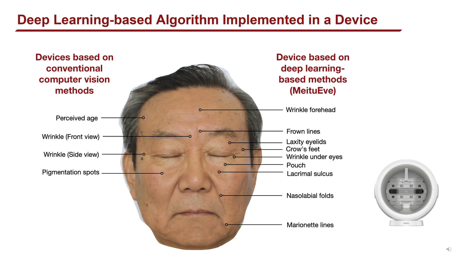 Quantifying facial skin aging signs by deep learning-based algorithm (2022) - Page 4