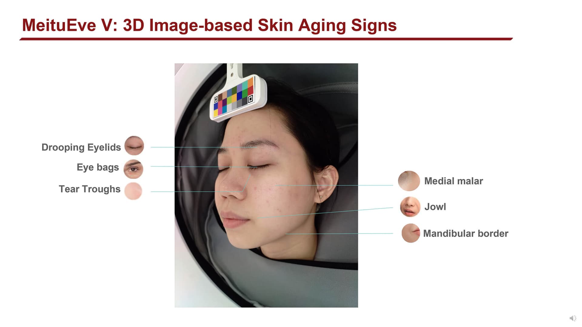 Quantifying facial skin aging signs by deep learning-based algorithm (2022) - Page 9