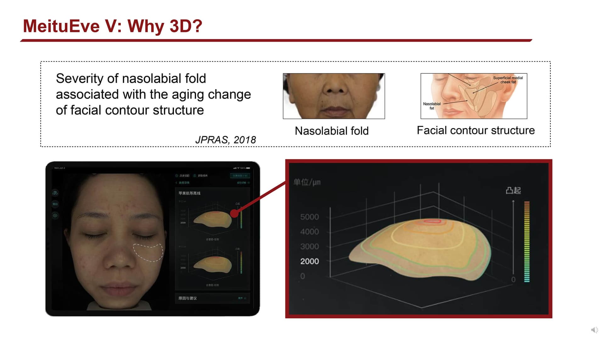 Quantifying facial skin aging signs by deep learning-based algorithm (2022) - Page 11