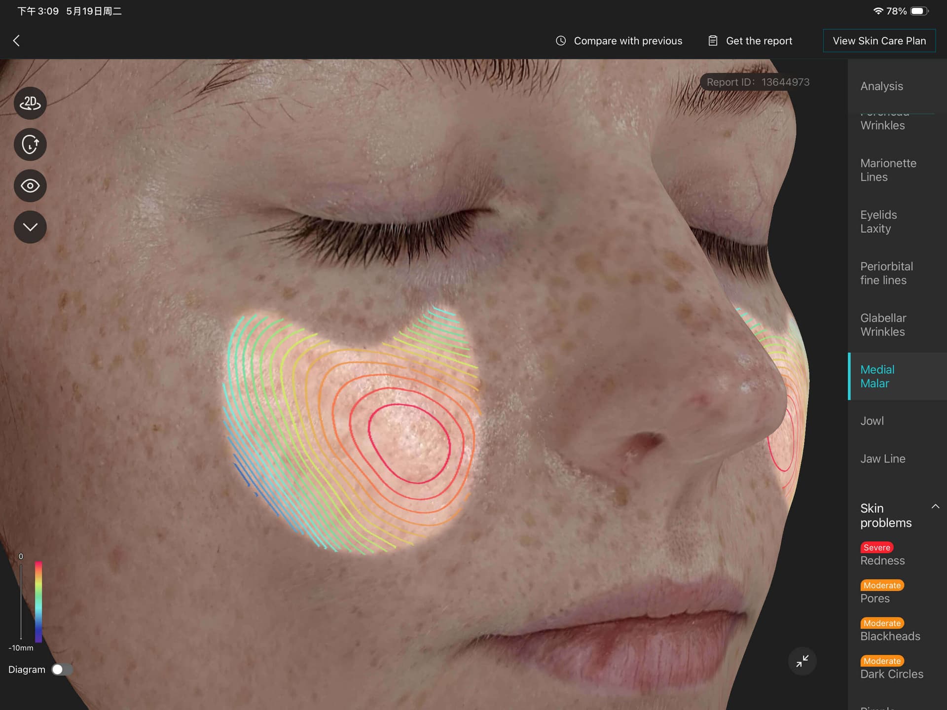 Contour Analysis